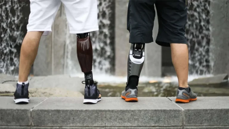 The Life-Changing Benefits of 3D Printed Prosthetics