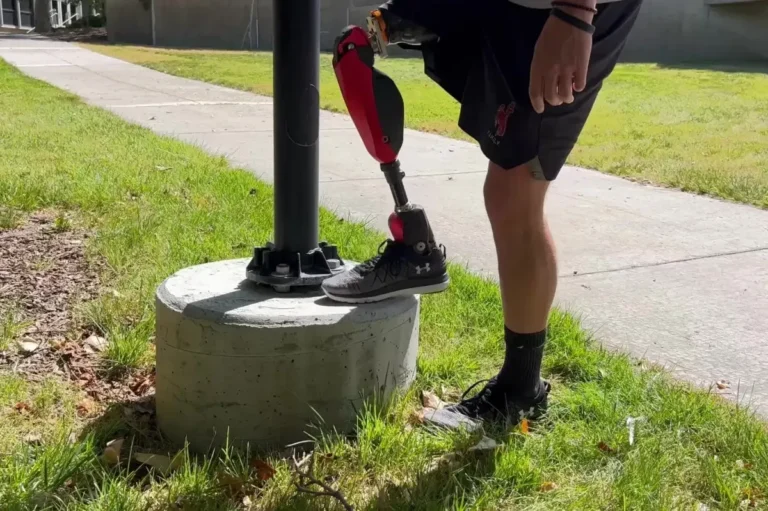 Getting Back on Your Feet with Prosthetic Legs