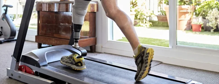 How Modern Prosthetic Devices Are Changing Amputee Rehabilitation