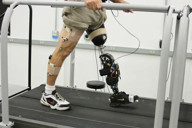 Find Out What’s New in Bionic Prosthetic Leg Design