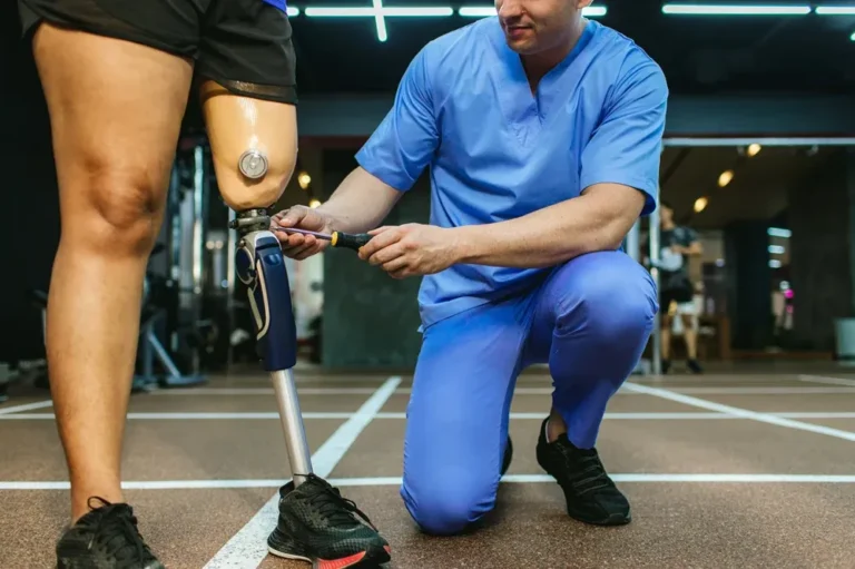 Amputee Rehabilitation: Steps Toward Physical and Mental Recovery