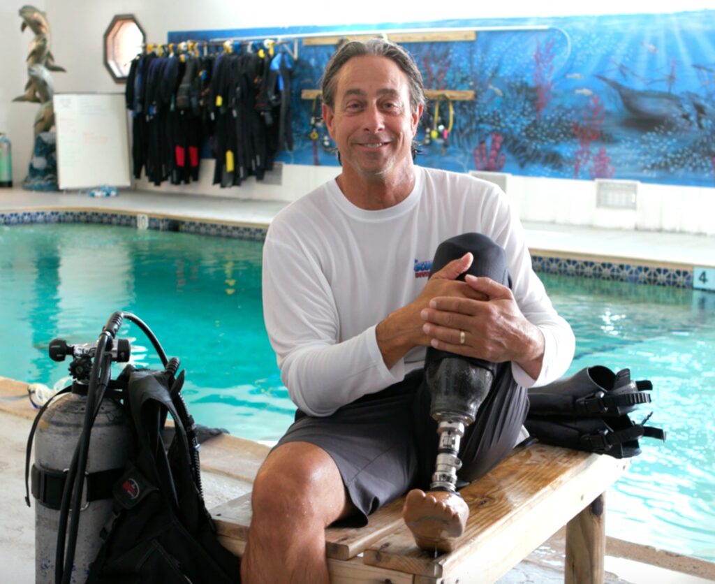 amputee rehabilitation at OPC Physical Rehabilitation in Fort Myers