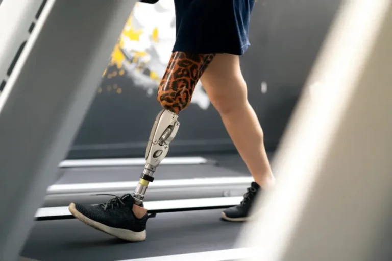 Tips for Walking on a Prosthetic Leg for the First Time