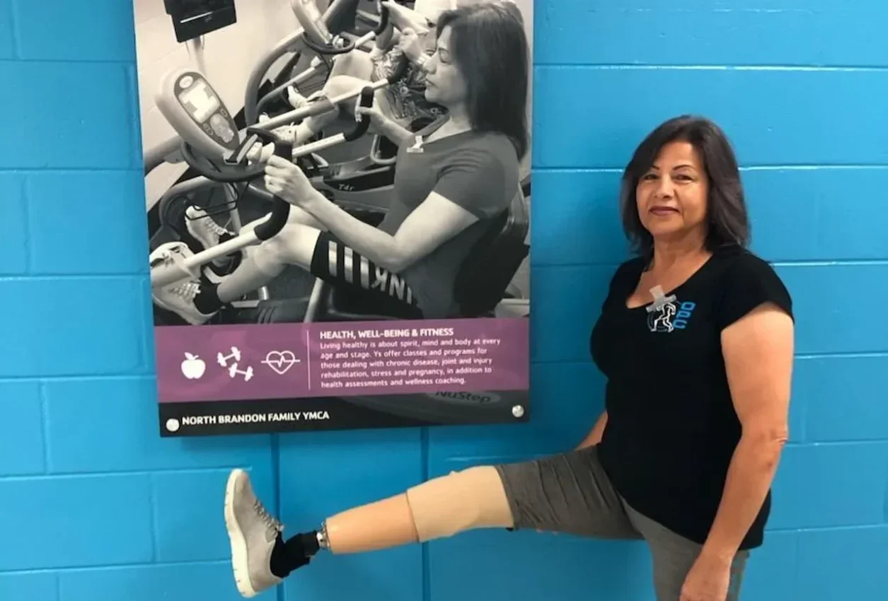 Prosthetic Rehabilitation Fort Myers