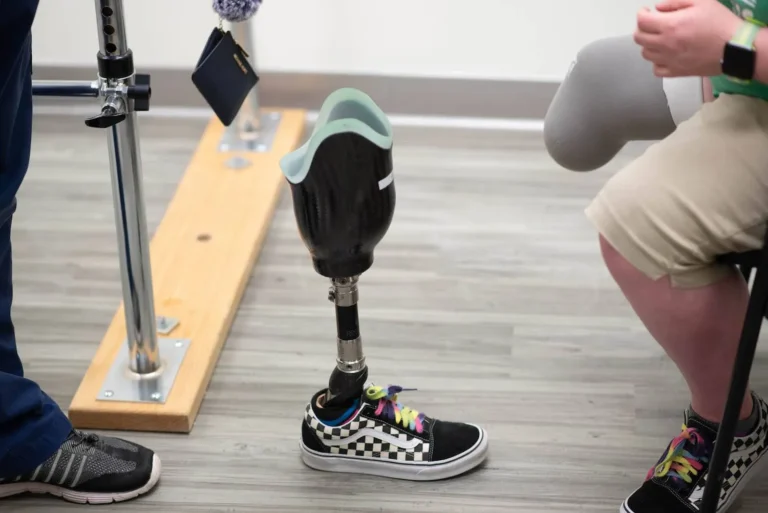 managing phantom limb pain
